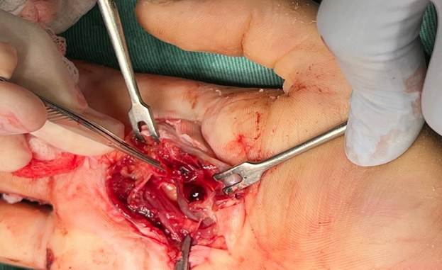 Persona con cuchillo en la mano

El contenido generado por IA puede ser incorrecto.